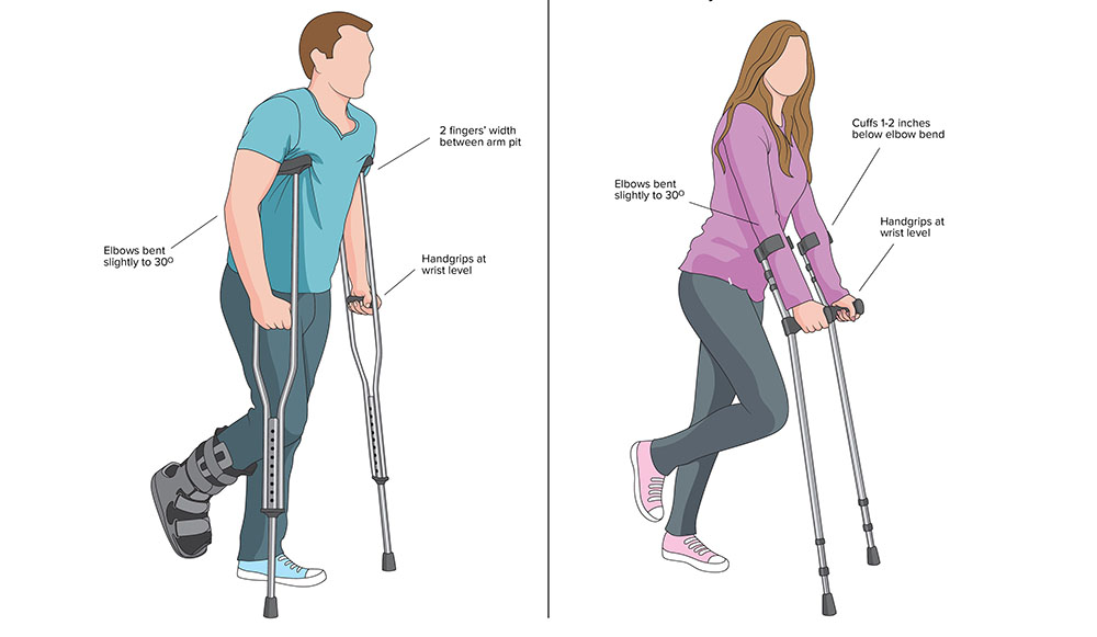 investing fascia of forearm crutches
